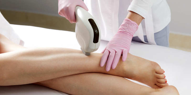 Laser Treatment for Skin: How It Helps Improve Your Skin