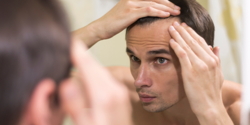 How to Stop Hair Loss in Men A Complete Practical Guide