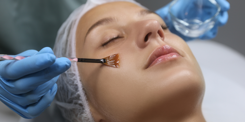 LACTIC ACID PEEL AT HOME IN PUNE — at-home treatment by AIIMS-certified dermatologists at Avataar Skin