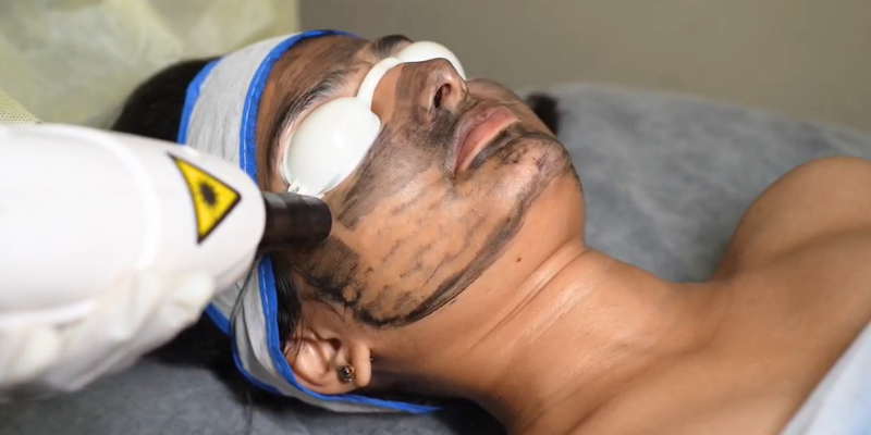 What is Q-Switch Laser Treatment: Complete Guide