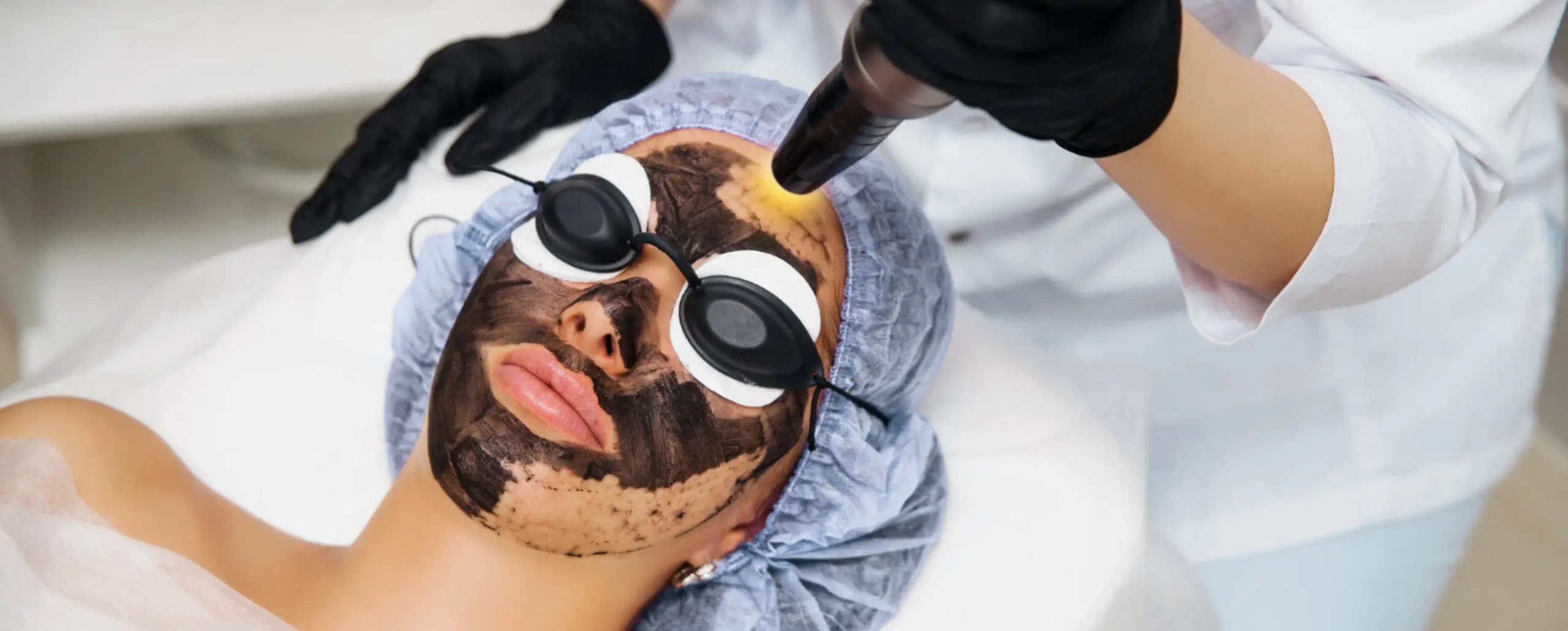 Q Switch Laser Treatment At Home In Gurgaon — at-home treatment by AIIMS-certified dermatologists at Avataar Skin