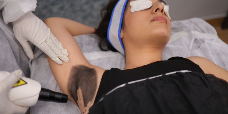 ARMPIT WHITENING TREATMENT IN NOIDA — at-home treatment by AIIMS-certified dermatologists at Avataar Skin