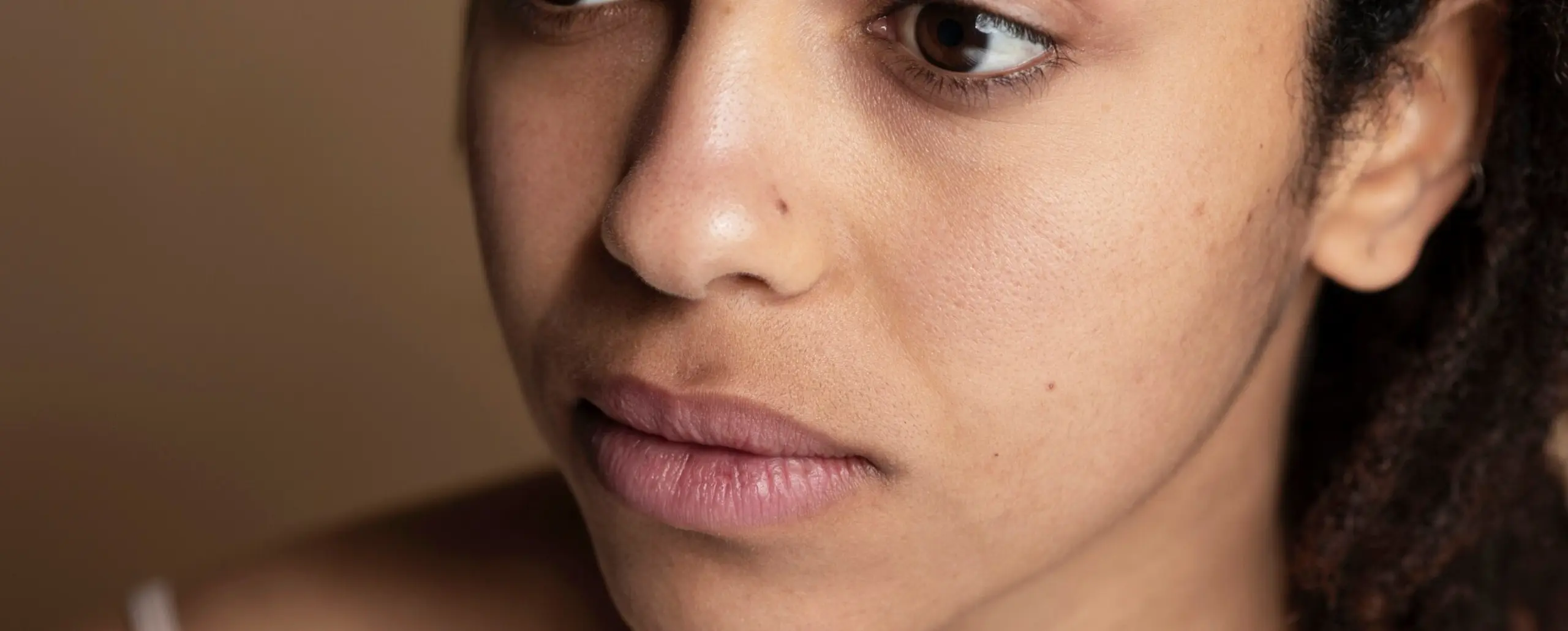 At-Home Open Pores Treatment in Pune — at-home treatment by AIIMS-certified dermatologists at Avataar Skin