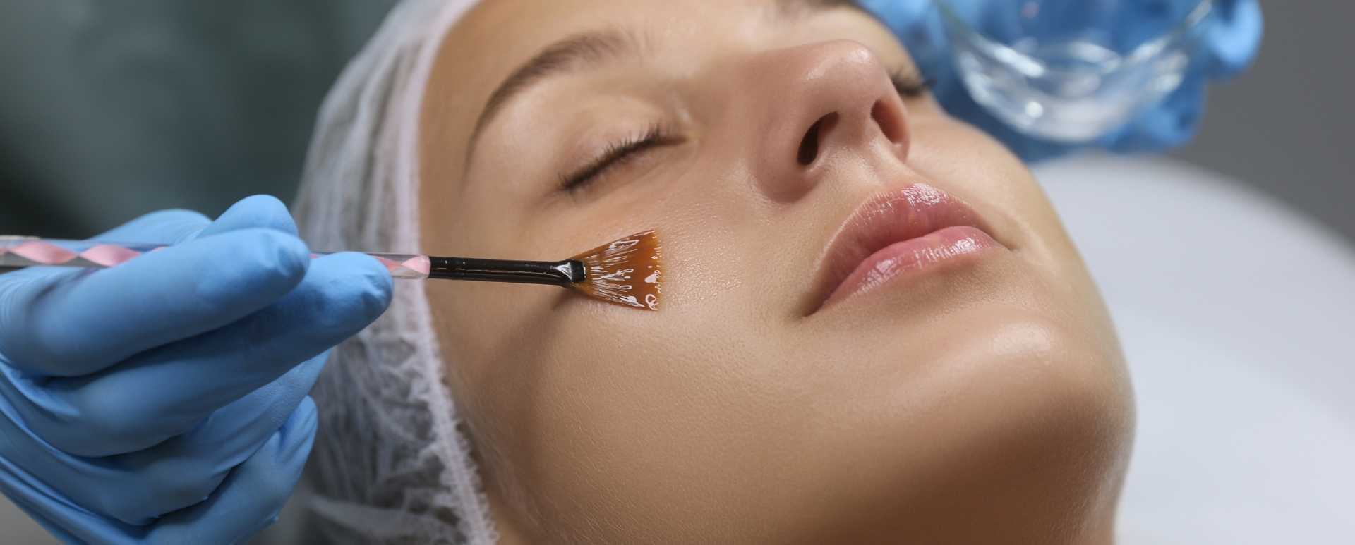 Chemical Peels IN BANGALORE — at-home treatment by AIIMS-certified dermatologists at Avataar Skin
