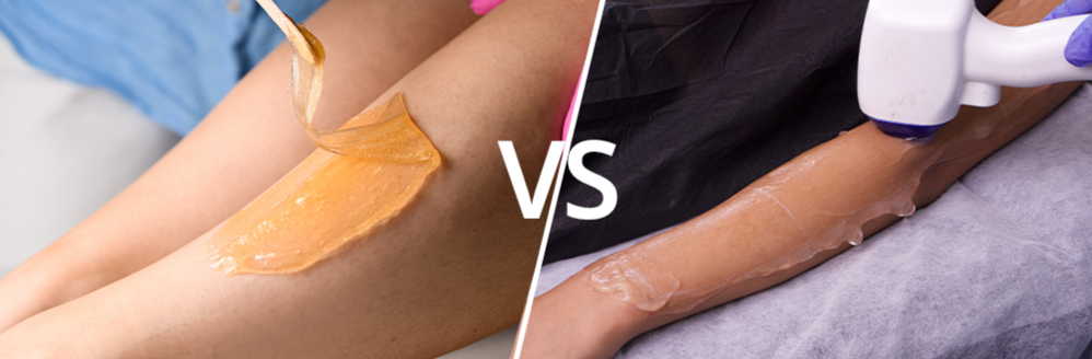 Waxing vs Laser